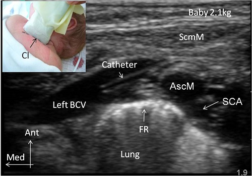 fig 2_BCV