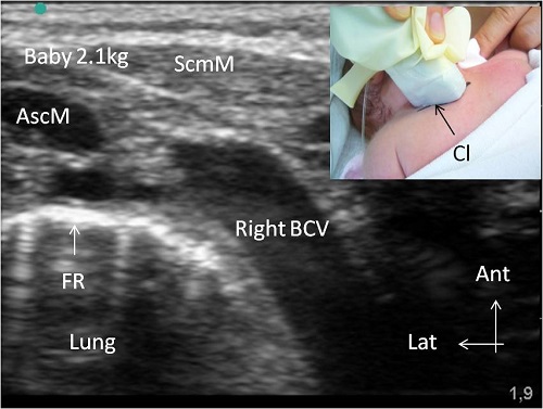 fig 3_BCV