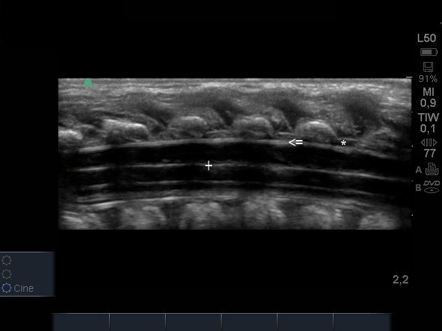 epid.an.fig1