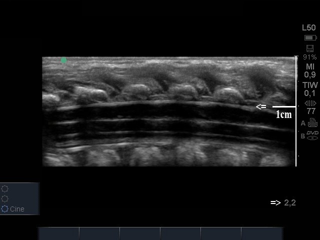 epid.an.fig2